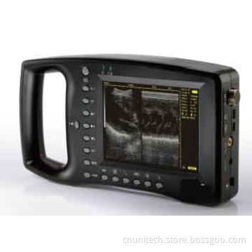 Palmsmart Ultrasound Scanner